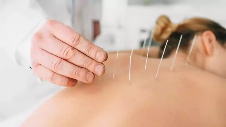 Acupuncture services in new york city