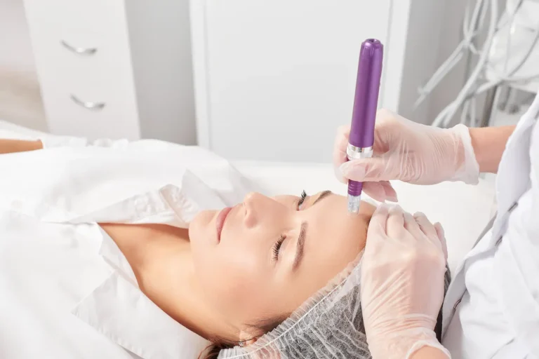 microneedling near me in new york city