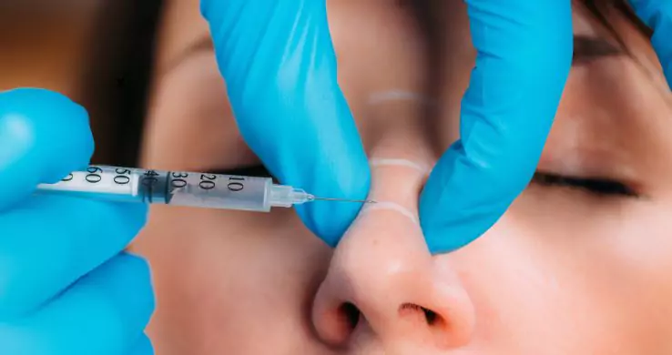 Dermal Fillers For Nose