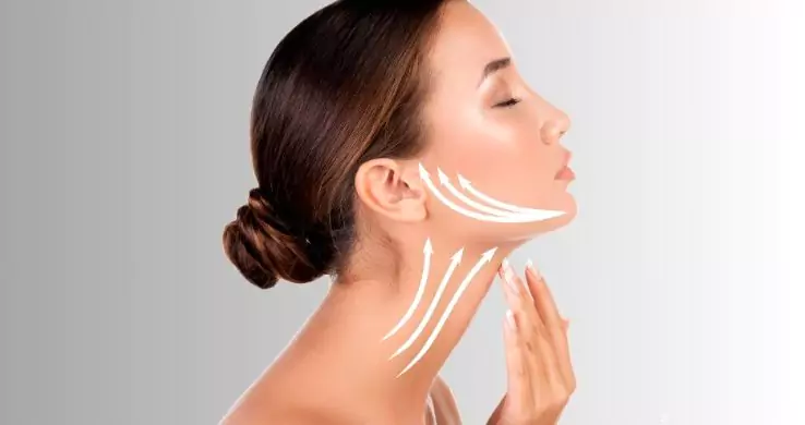 Facelift And Neck Lift