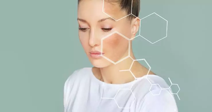 Skin Boosters vs Dermal Fillers